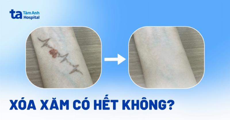 Quá trình lựa chọn mẫu hình xăm hoa dựa trên ý nghĩa cá nhân và sở thích thẩm mỹ